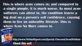 Acne No More The Secrets To Curing Your Acne Holistically - Acne No More Product