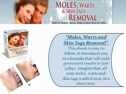 MOLES WARTS AND SKIN TAGS REMOVAL ++GET SPECIAL DISCOUNT++