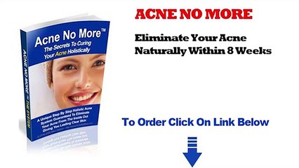 Acne No More [WARNING] Acne No More Review