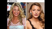 Daily D10 Hot videos updates 20 celebrities before and after Surgery that will make you Wonder !!! BY1 Hot Fresh videos