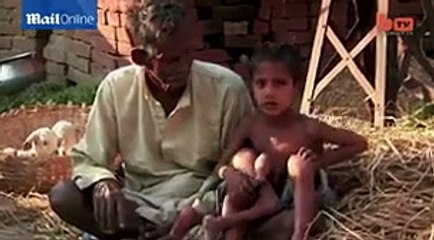 Baby in India born with four arms and legs dubbed God Boy by parents -