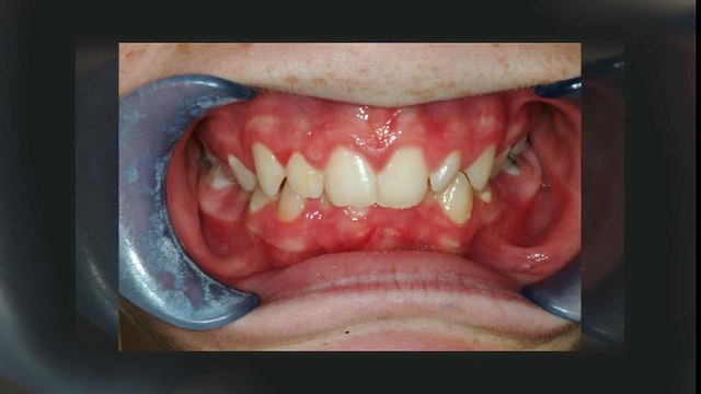 Duryea Braces Littleton - (303) 933-0300