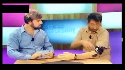 Protez kol canlı yayında tutukluk yaparsa