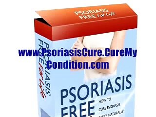 How To Treat Psoriasis Naturally Without Immunosuppressants - Psoriasis Free For Life Review