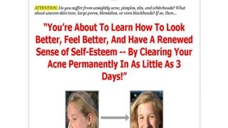 Acne Free In 3 Days