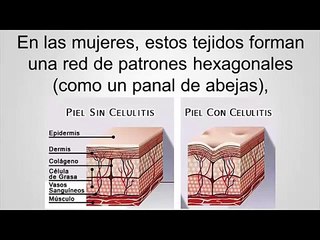 adios celulitis ¡Si! adiós celulitis