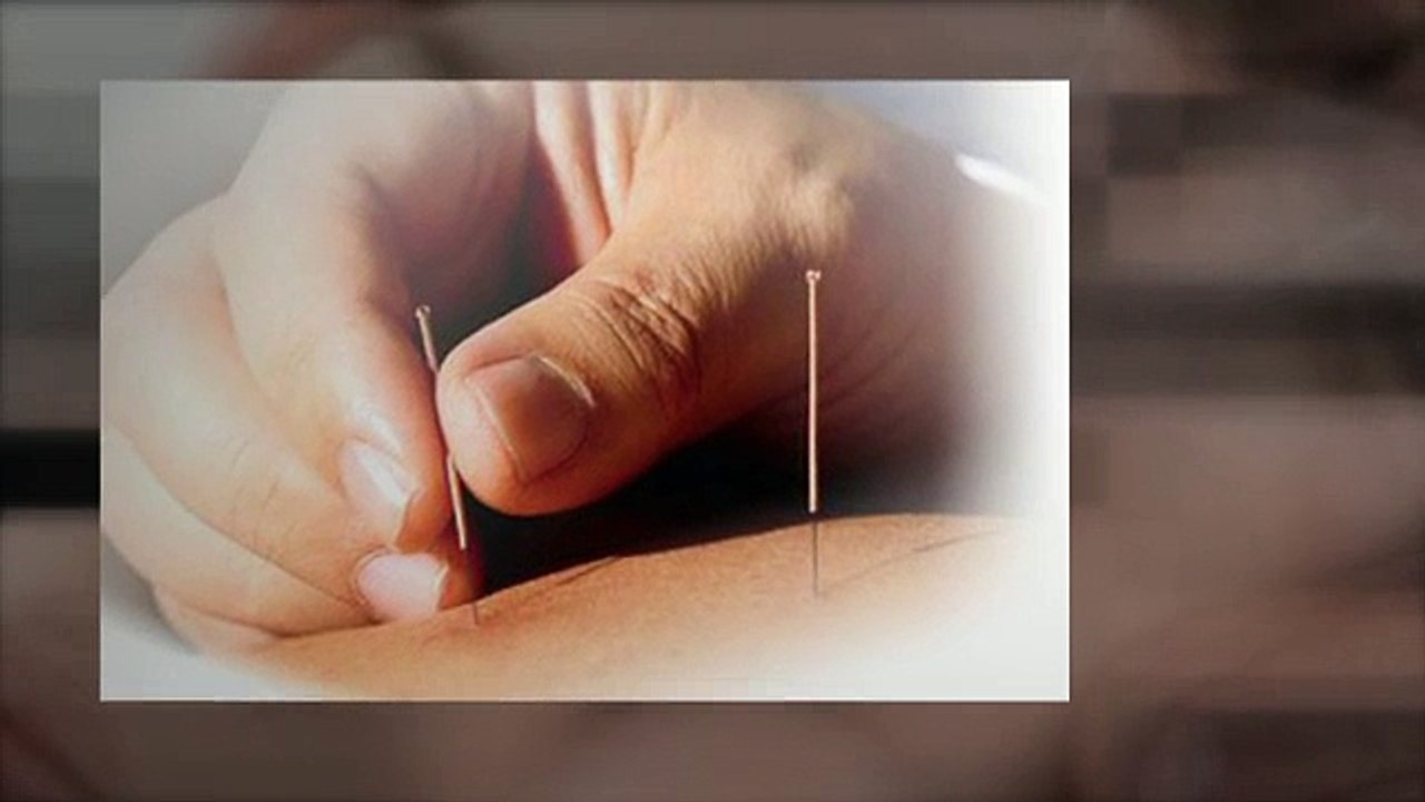 Acupuncture Depression Torrance