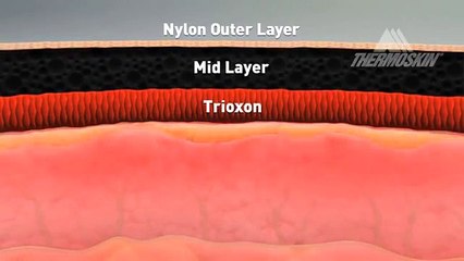 Thermoskin Plantar FXT for Relief of Plantar Fasciitis
