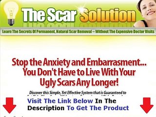 The Scar Solution THE HONEST TRUTH Bonus + Discount