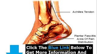 Plantar Fasciitis Tips + Plantar Fasciitis Home Treatment