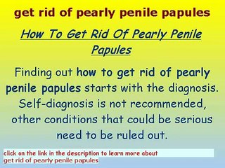 Download Video: Pearly penile papules Removal toothpaste - pearly penile papules removal system