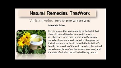 Varicose Veins Treatment Natural using Herbs for Varicose Veins