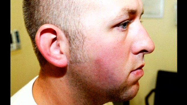 Photos show Ferguson police officer after Brown shooting