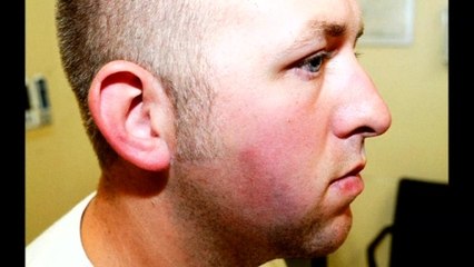 Photos show Ferguson police officer after Brown shooting