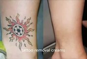 easy way get rid tattoo   Tattoo Removal Cream