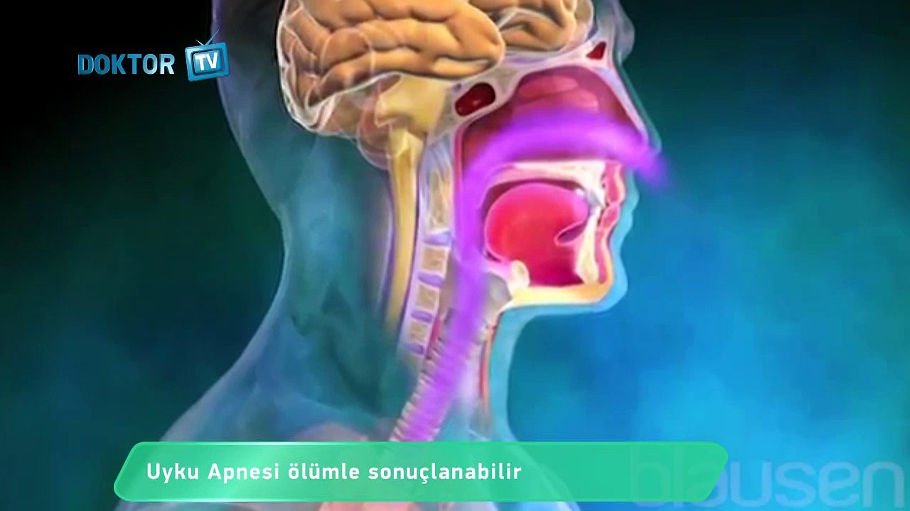 Uyku apnesi ölümle sonuçlanmasın!