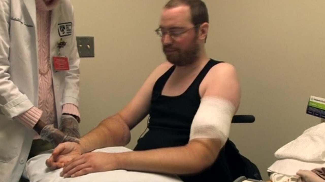 Double-arm transplant recipient thanks doctors in Boston