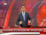 Boşanmak isteyen eşine inat Akupunktur tedavisiyle 58 kilo verdi