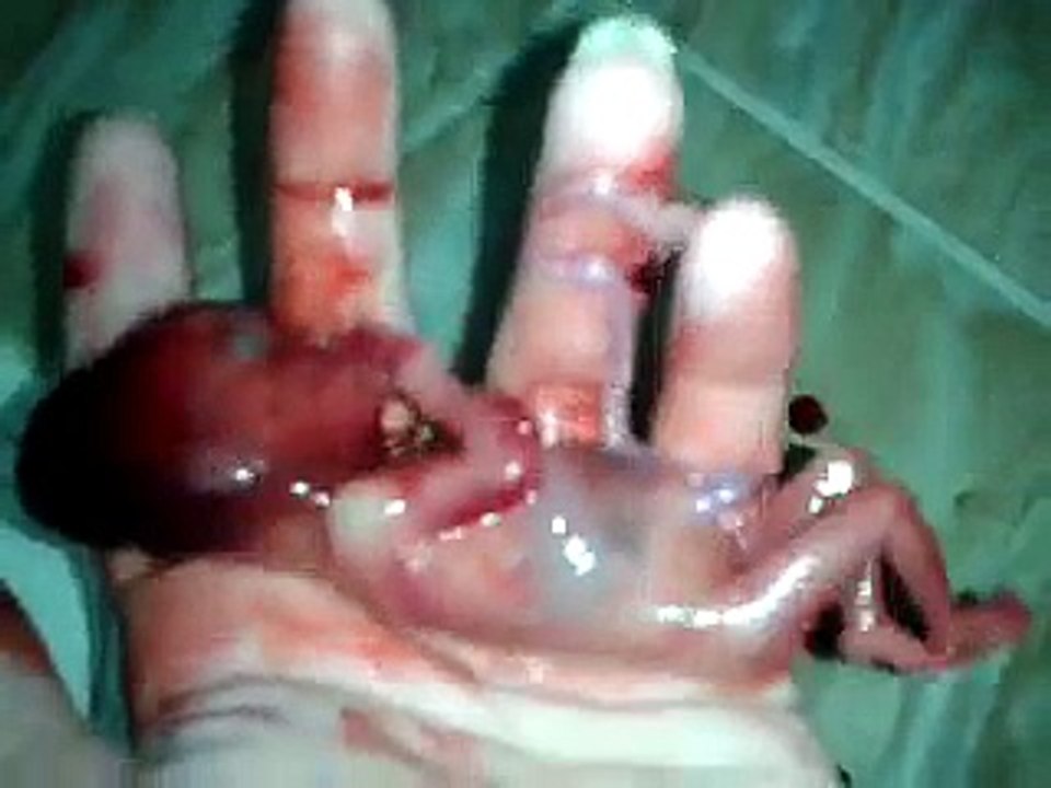 New Baby Born 3 Inches