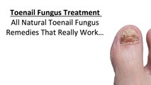 Natural Toenail Fungus Remedies: Clear Fungal Nail Infections All-Naturally