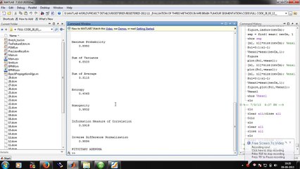 Evaluation Of Mri Brain Segmentation