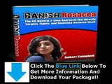 Banish Rosacea Ebook Download   Does Banish Rosacea Work