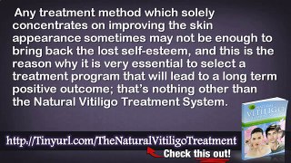 Natural Vitiligo Treatment System Download And Natural Treatment For Vitiligo In Children
