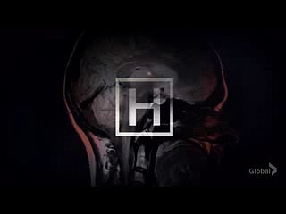 당초 사망논현풀사롱 20명이었으나철산풀사롱18두정풀사롱3871명이