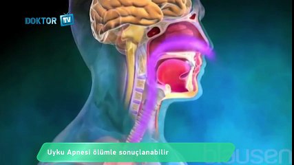 Uyku Apnesi Ölümle Sonuçlanmasın!