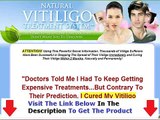Natural Vitiligo Treatment System Unbiased Review Bonus   Discount