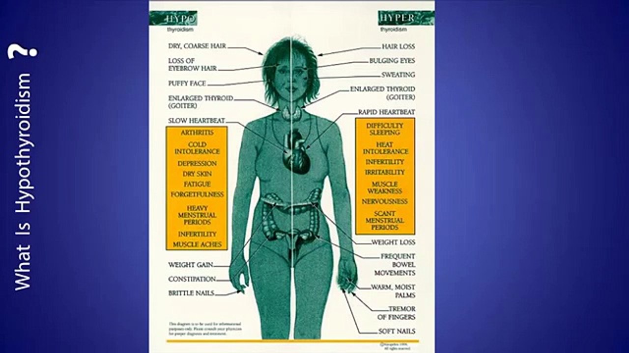 Hypothyroidism Revolution Review - Hypothyroidism Revolution