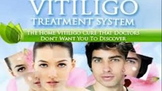 Natural Vitiligo Treatment System - Natural Vitiligo Treatment System Reviews