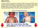 Don't Buy Eczema Free Forever Eczema Free Forever Review Bonus + Discount