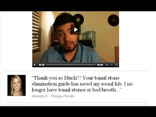 Banish Tonsil Stones