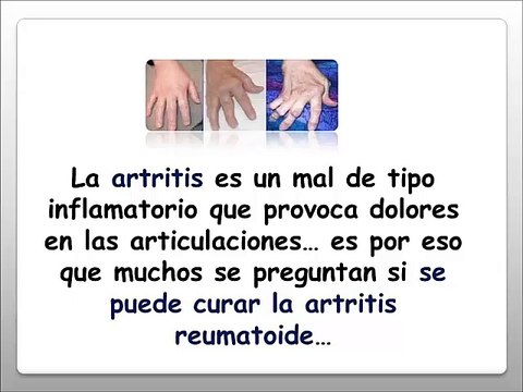 Se Puede Curar La Artritis Reumatoide - Artritis Reumatoidea Tratamiento