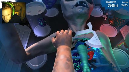 ALIEN SURGERY! - Surgeon Simulator 2013 (Pewdsball Success)