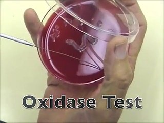 Bacterial oxidase test.(shared by athar ali)
