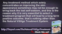 Natural Vitiligo Treatment System Does It Work And Natural Treatment For Vitiligo