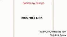 Banish my Bumps Review (Top 2014 website Review)