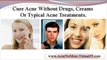 best acne treatment - rosacea treatment - get rid of acne