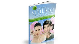 Natural Vitiligo Treatment System Review +++100% Real and Honest+++