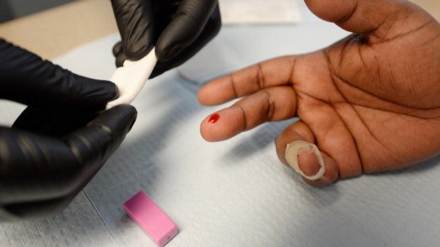 Curing AIDS Is Just A Matter Of Time At This Point