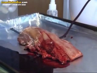 20 Saniyede Kanamayı Durduran Buluş