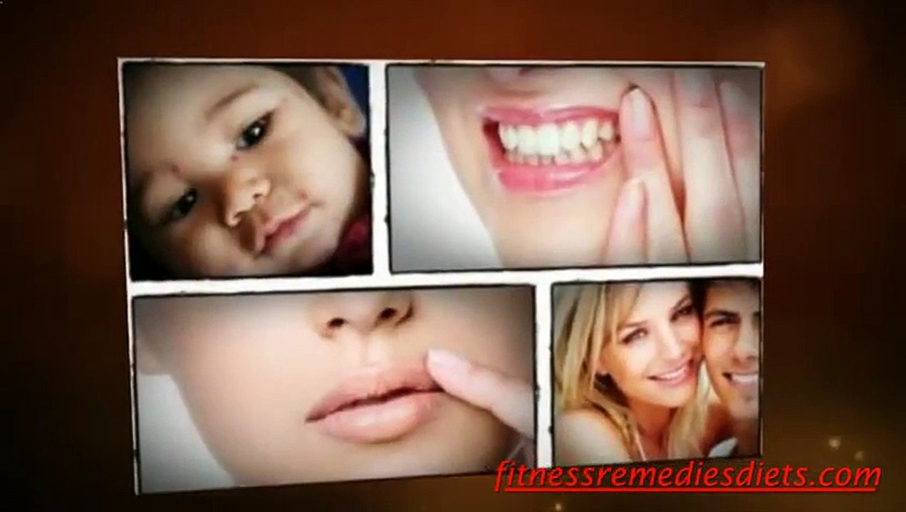 What Causes Herpes Simplex 1
