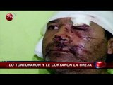 Hombre fue torturado y le cortaron la oreja en Lo Prado - CHV Noticias