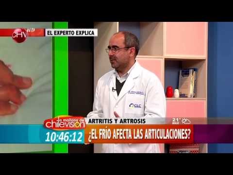 Conozca a fondo todo sobre la Artrosis y la Artritis - La Mañana de CHV