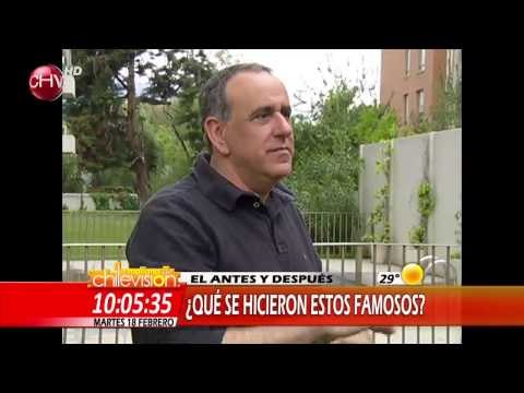 Las cirugías de los famosos - La mañana de Chilevisión