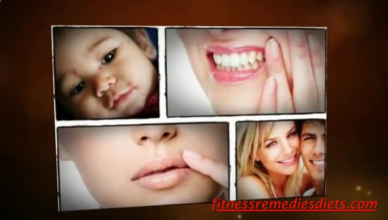 Herpes Types