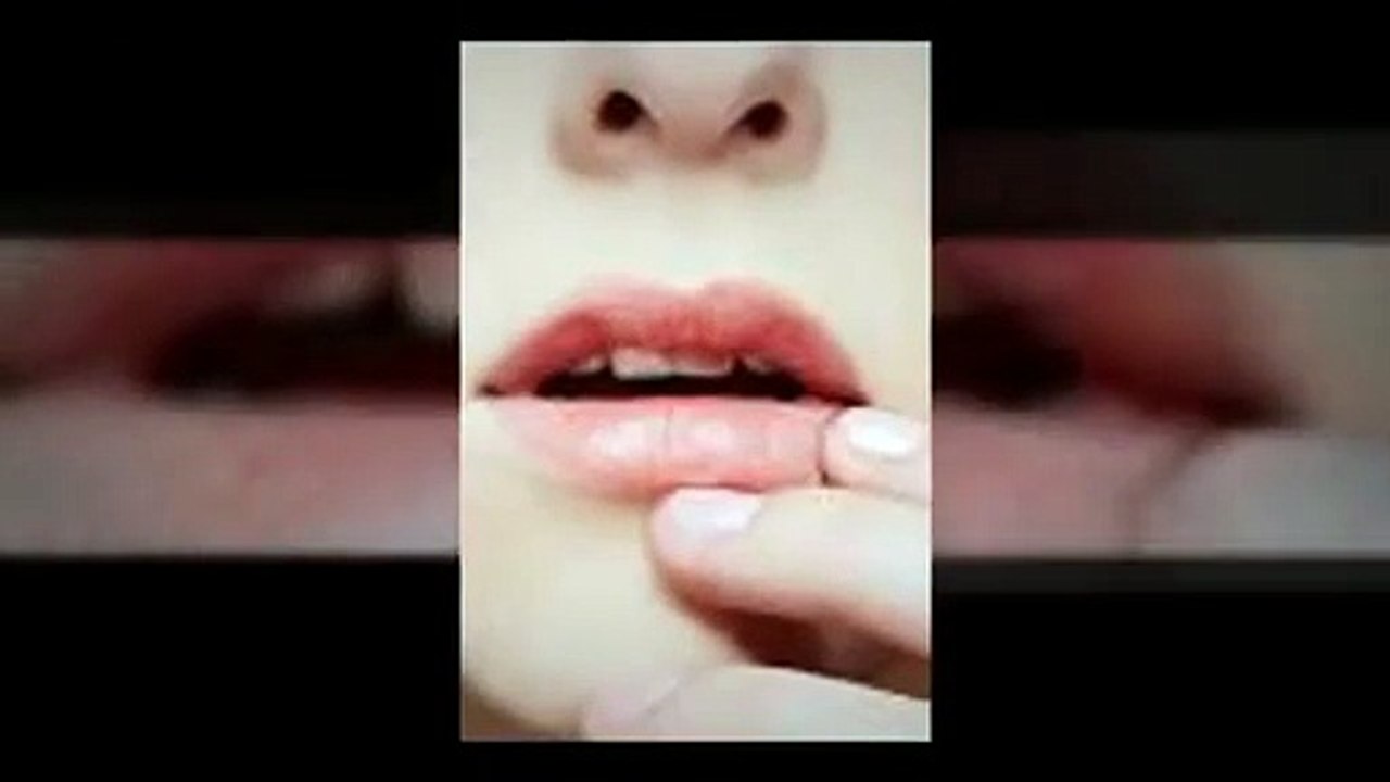 How To Get Rid Of Herpes Fast - Top 5 Tips To Treat Herpes Outbreak