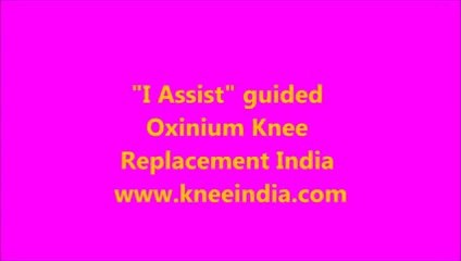 I-Assist guided Verilast CR Knee Replacement India